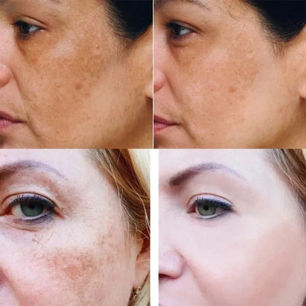 Kurkumowe serum wzmacniające blask | Kurkuma Pielęgnacja skóry | Korektor ciemnych plam | Naturalne składniki | 30 ml | Formuła wzbogacona w przeciwutleniacze | Rozjaśnia i wyrównuje koloryt skóry | Nawilżenie przeciwstarzeniowe | Serum do twarzy